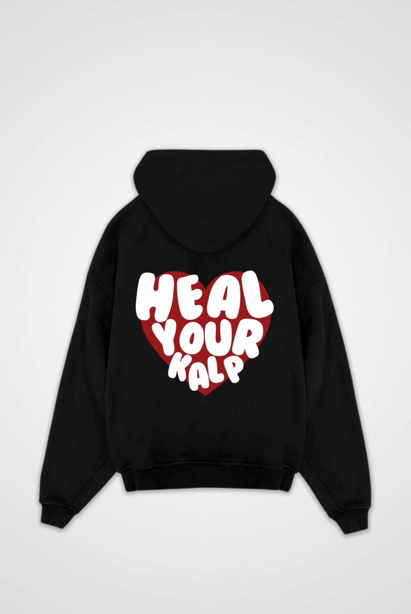 KALP Oversized Hoodie – Produktansicht